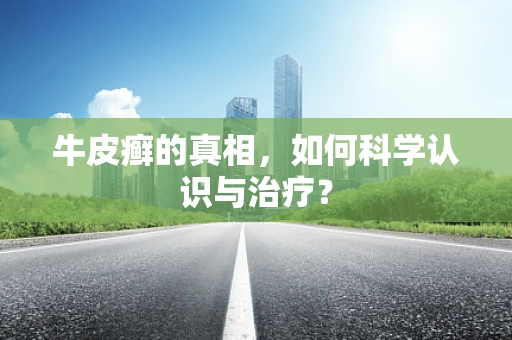 牛皮癣的真相，如何科学认识与治疗？