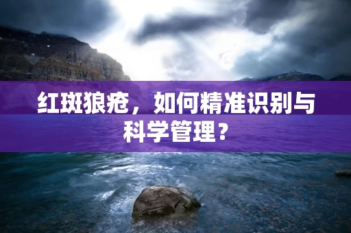 红斑狼疮，如何精准识别与科学管理？