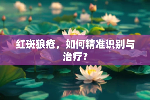 红斑狼疮，如何精准识别与治疗？
