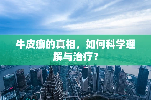 牛皮癣的真相，如何科学理解与治疗？