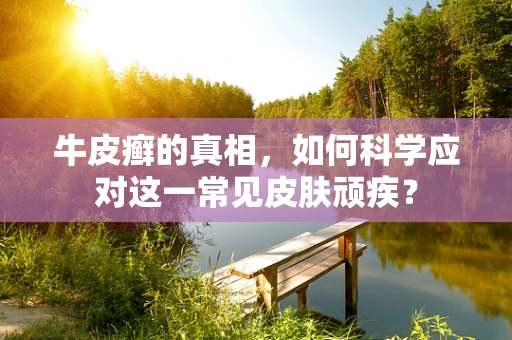 牛皮癣的真相，如何科学应对这一常见皮肤顽疾？