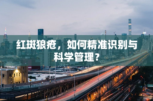 红斑狼疮，如何精准识别与科学管理？